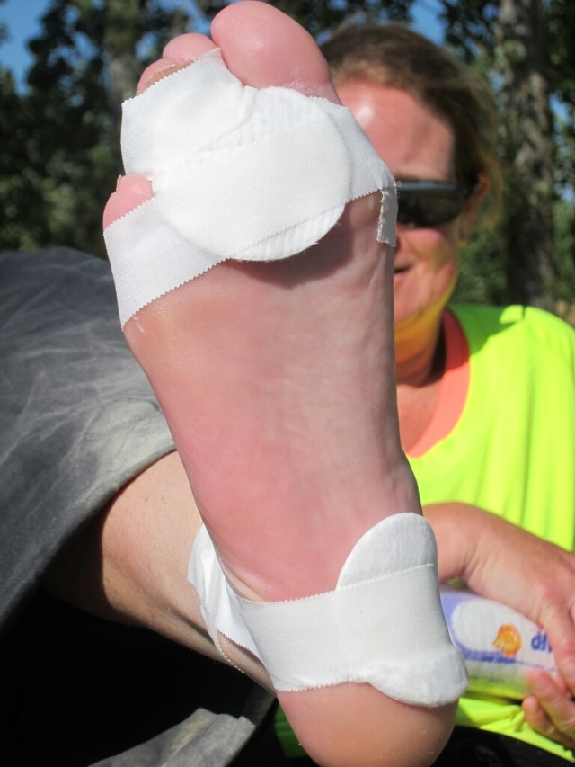Bottom of Heather's foot after taping it up for blisters.